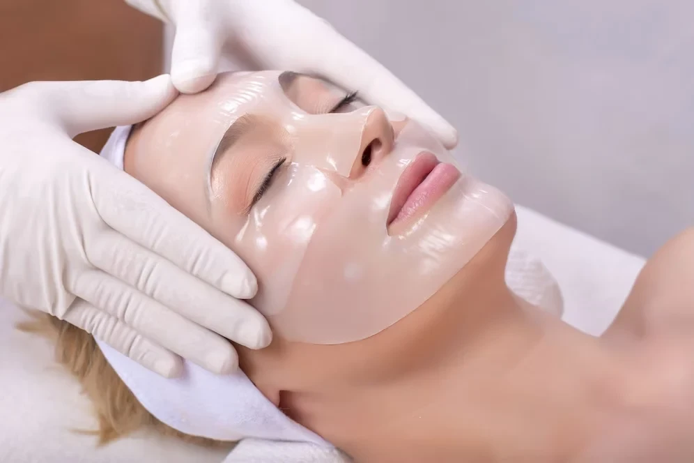 Chemical Peels