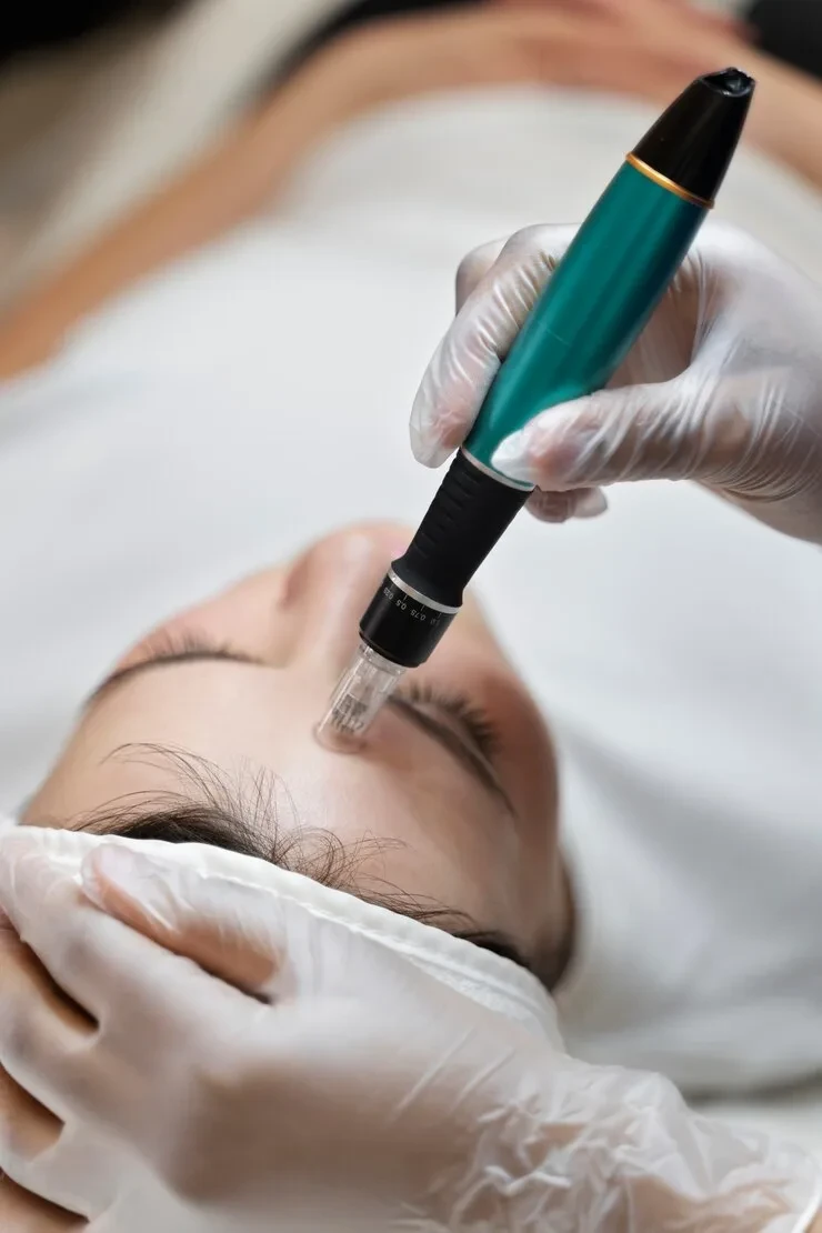 Microdermabrasion