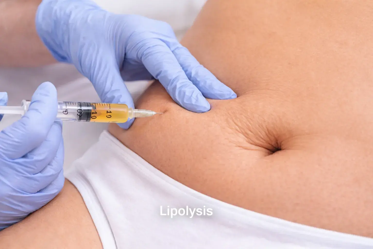 Lipolysis